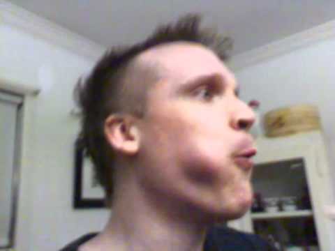 how to cure dry mouth