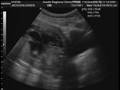 videos de Sonogram