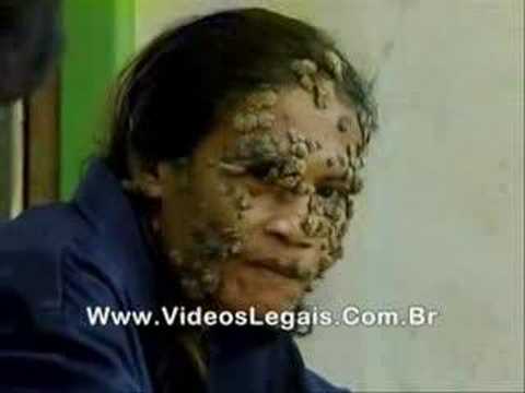 coisas bizaras - Videos Bizarros da internet!!! Super boca! Maior lingua! Olhos esbugalhados! Confira e Comente!