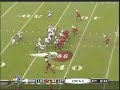 Viking's E.J. Henderson Breaks Leg Slow Motion