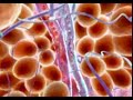 Endermologie Endermologie