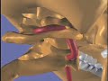 Treating Suboccipital Pain - Erik Dalton