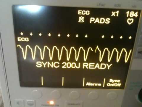 how to treat v tach with a pulse