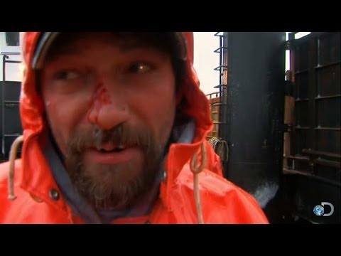Captain Johnathan Hillstrand Breaks His Nose | Deadliest Catch