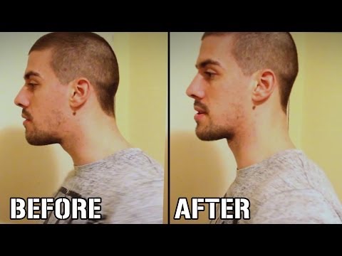 how to improve neck posture