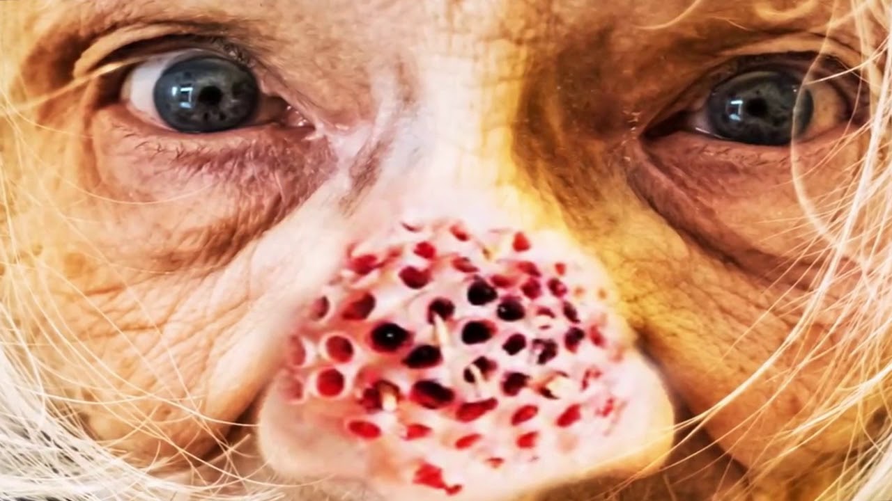 Video Gallery Trypophobia Reference Website