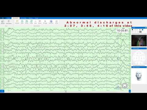 Watch '3yr Old Girl Sitting and Monitored via Zeto EEG'