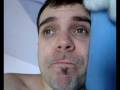 videos de My 3 Day Acne Cure Diary - I cured my acne and lost 7lb. Amazing Acne Free Treatment.