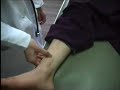 examination of leg edema