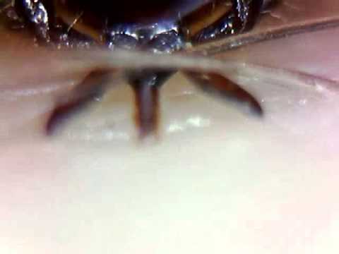 tick - I bought a Supereyes pen USB microscope some time ago, and had to practice with it for some time (and without too much coffee) to get it steady enough to sho...