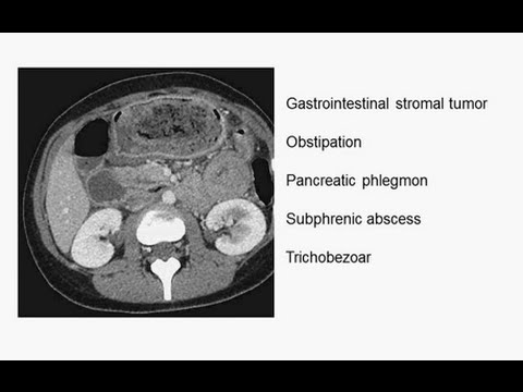 how to treat low hgb and hct