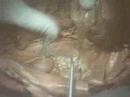 Blood vessels on the rabbit 2-Anatomy35 (Mtsac)