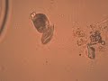 Protists