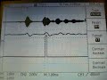 Demod of AURF signal with PWM and Comparator