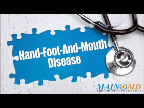 how to relieve symptoms of hfmd