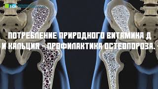 Остеопороз и его профилактика