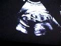 videos de Little Adelynne