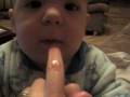 Rabid baby