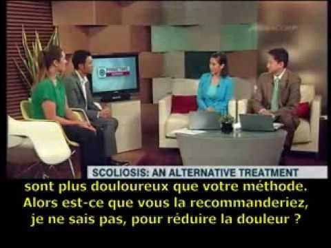 Klinovidnost du service de poitrine