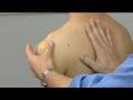 Understanding the Acupuncture Pressure Points