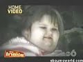 Caso Obesidad infantil