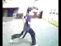 JIMMY THE BOY IDIOT CRACKS HIS FACE