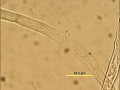 Pollen Germination in vitro
