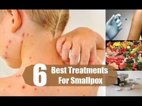 how to cure smallpox