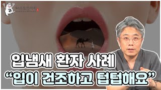 "입이 건조하고 텁텁해서 입냄새가 나요..." 원인과 해결법!