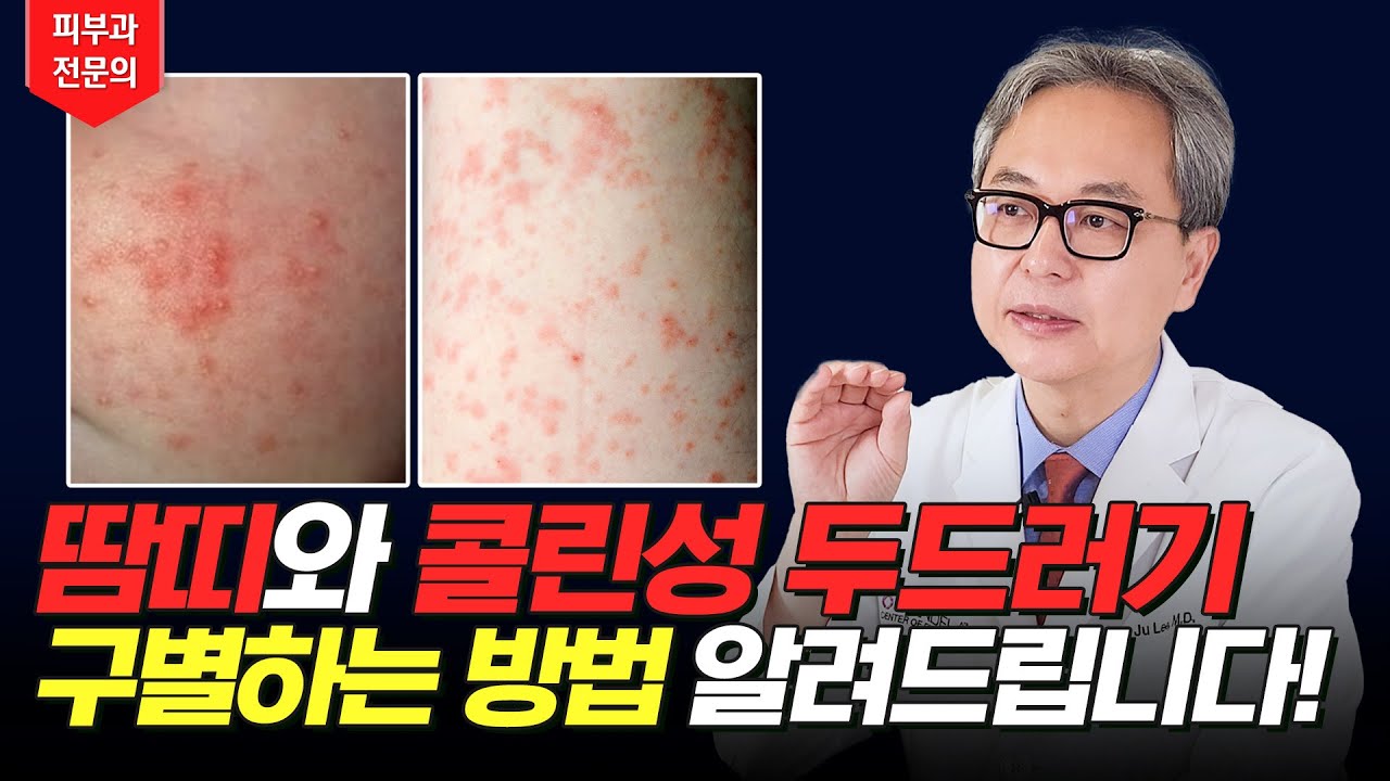 연세스타피부과 TV