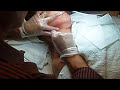 Terry Binns Teaching Extractions to Aesthetics Students