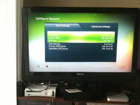 how to locate xbox ip address