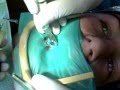 Root Canal