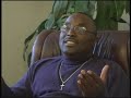 Gynecomastia Surgery: The Journey of Three Men (Highlights)