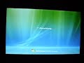 Acer Aspire One - Vista