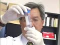Saliva Test for Oral Cancer, UCLA Saliva Test for Oral Cancer, UCLA
