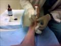 Cortisone Shot
