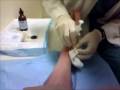 Cortisone Shot