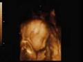 4D Baby Scan Family