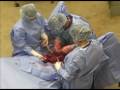 horse colic surgery  dr.  klohnen