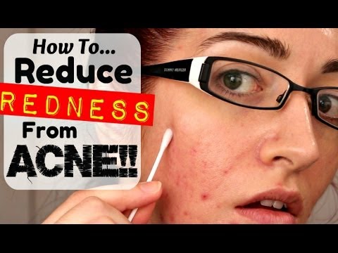 how to make acne redness go away