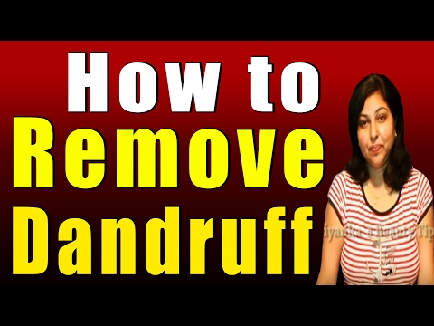 how to control dandruff at home