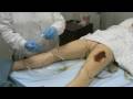Sterile Urine Specimen & Foley Catheter removal