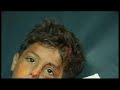  palestinians israel settlers hebron boy attacked stone throwing todd baer aljazeera