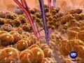 Endermologie and Lypomassage by Transfit Cape Town Endermologie and Lypomassage by Transfit Cape Town