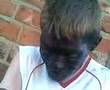 craigsmith smashed of his face