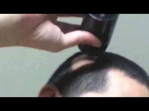 how to cover a bald patch on your head