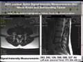 2001 Lumbar Spine MRI Signal Intensity Measuremts.: 25-1001 Hz