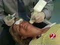 Thermage: Facelift of the Future - WESH 2 with Orlando\