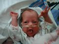 Micro-Preemie Lily